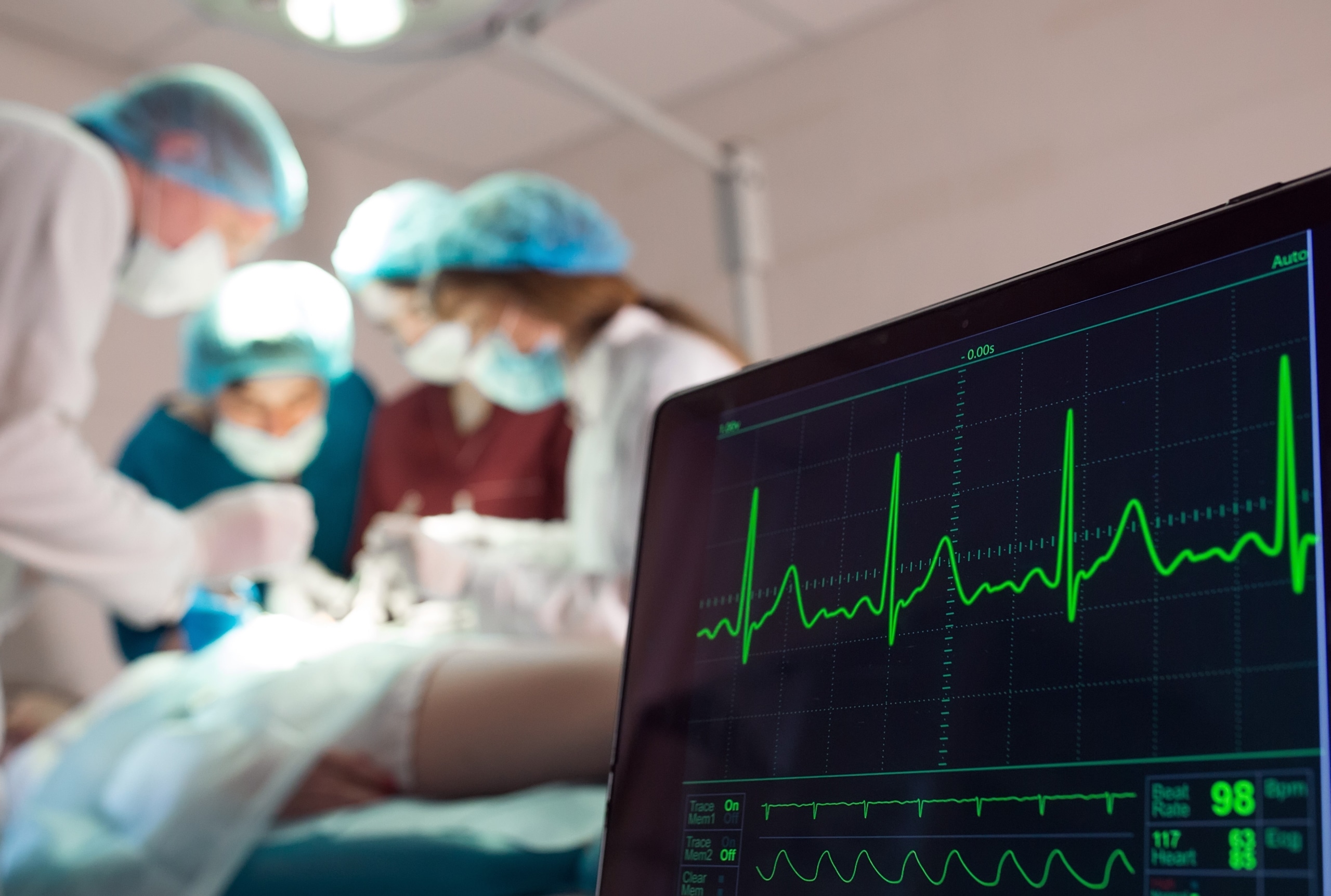 Close up of a heart monitor in an operating room