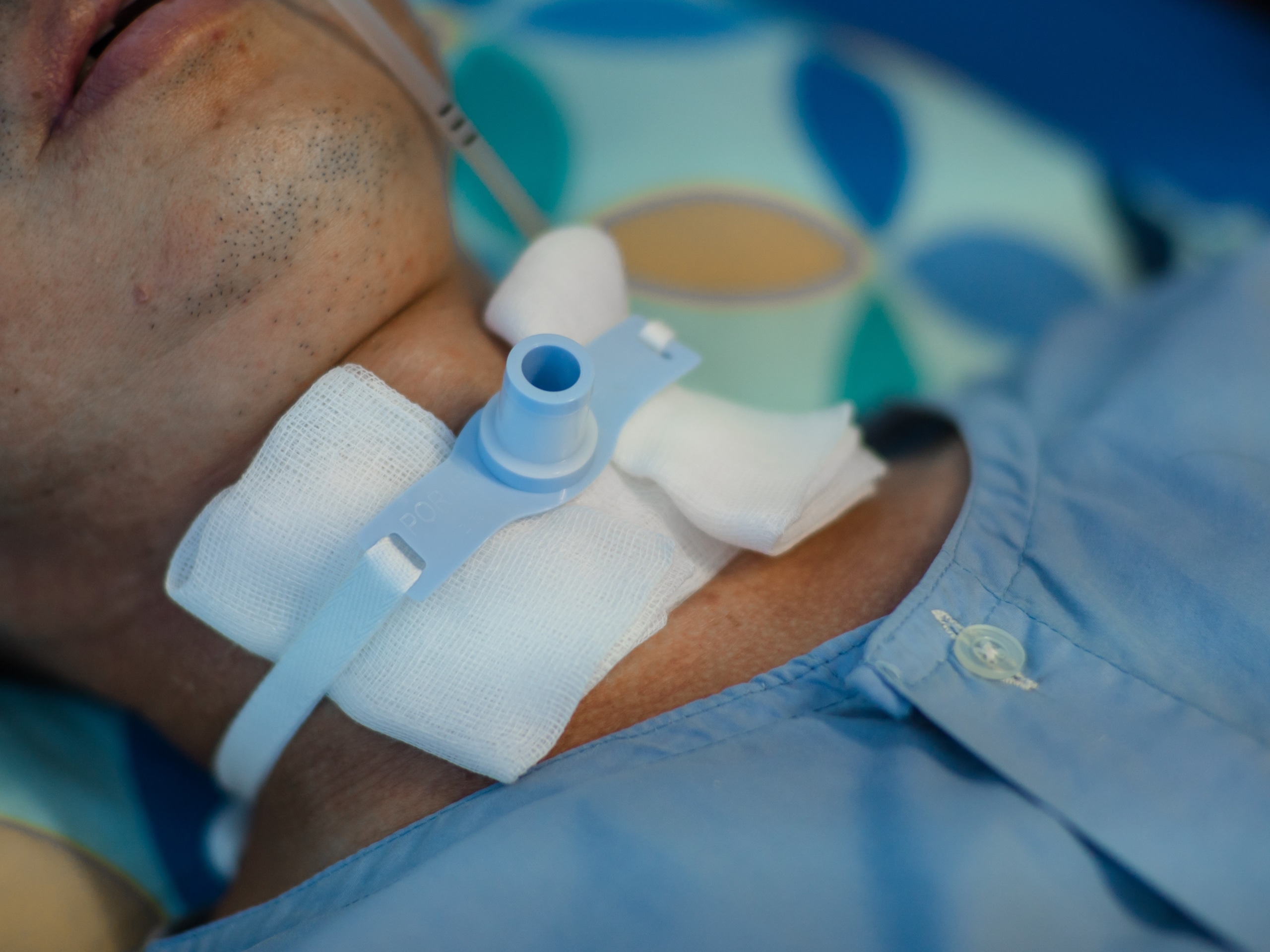 Patient with a tracheostomy