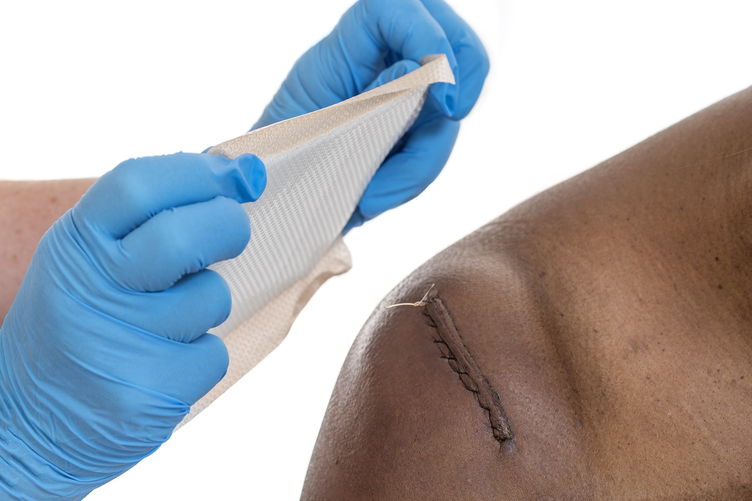 Medical professional covering stitches