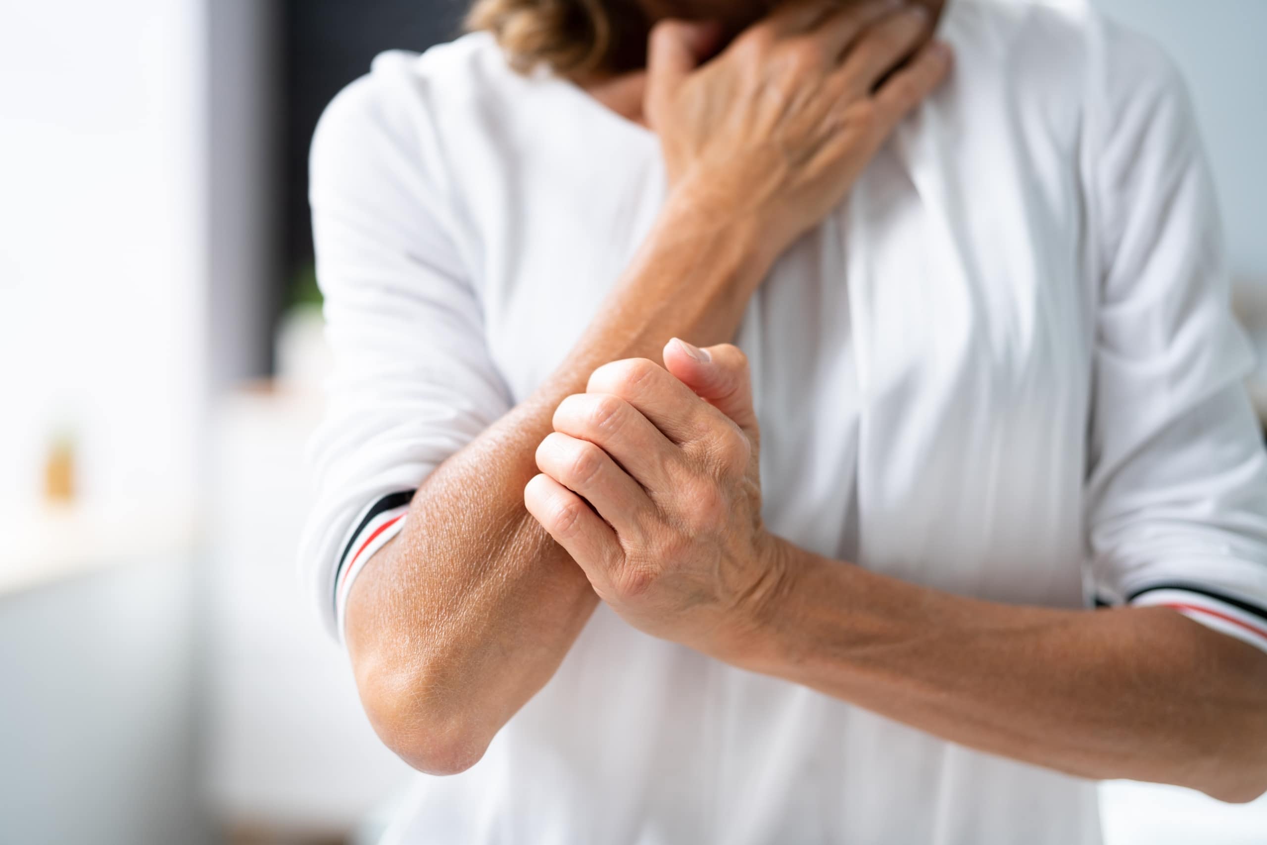 Close up of a woman scratching her arm