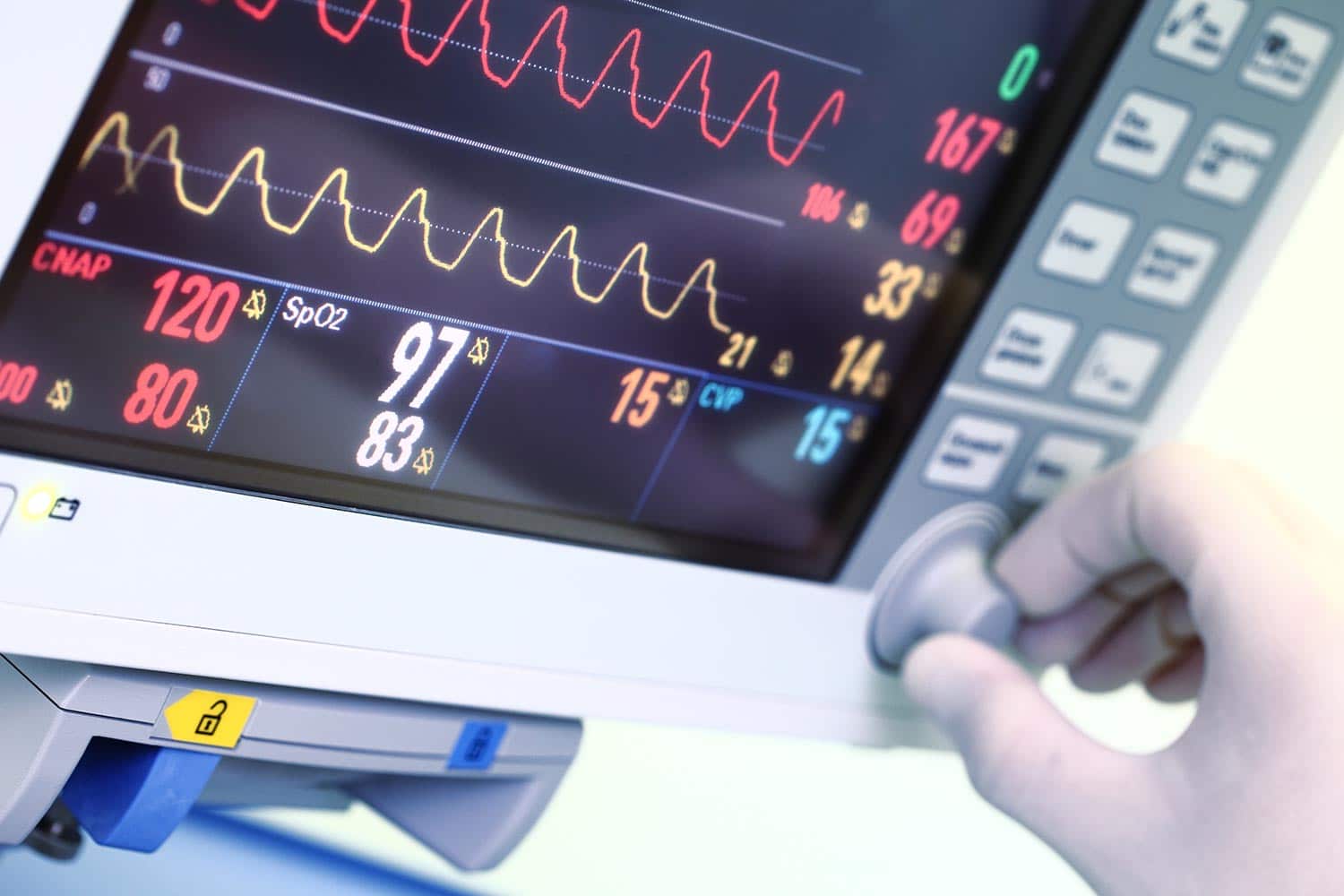 Close up of EKG equipment and readings